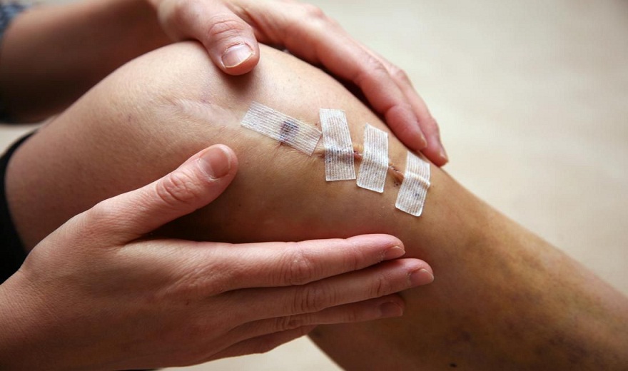 5 chấn thương thể thao đầu gối thường gặp, phổ biến 5 chấn thương thể thao đầu gối thường gặp, phổ biến